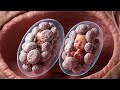🤰 Twin pregnancy — a look inside #TwinPregnancy #BabyDevelopment #PregnancyJourney #TwinMom