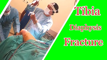 Medical documentary - Real Truth (Tibia Diaphysis Fracture)