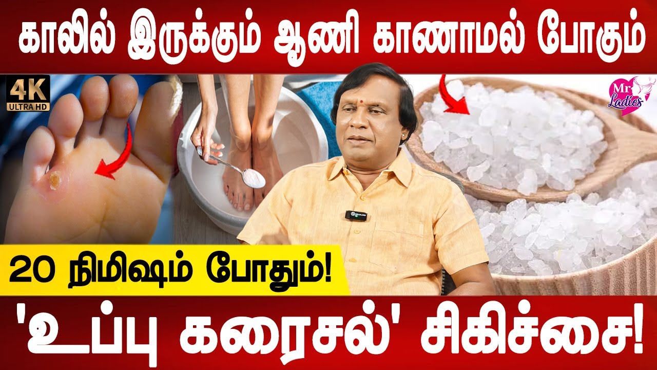 வீட்டில் நீங்களே தயாரிக்கலாம் | Natural Remedies for Foot Corn | Kal aani homeremedy | Mr ladies