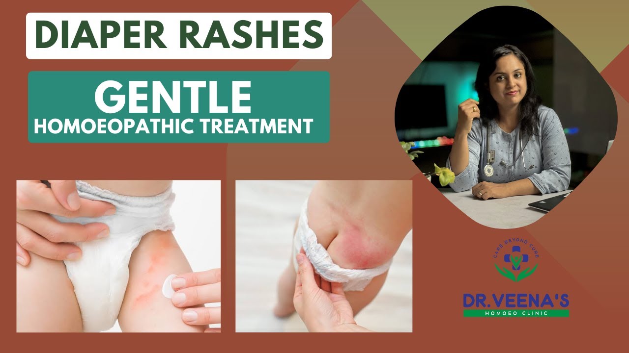 Diaper Rashes | Baby Rashes | Nappy Rashes | Gentle Cure | Buttock ...