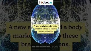 Aging Affects The Brain - But Lifestyle Can Make A Difference