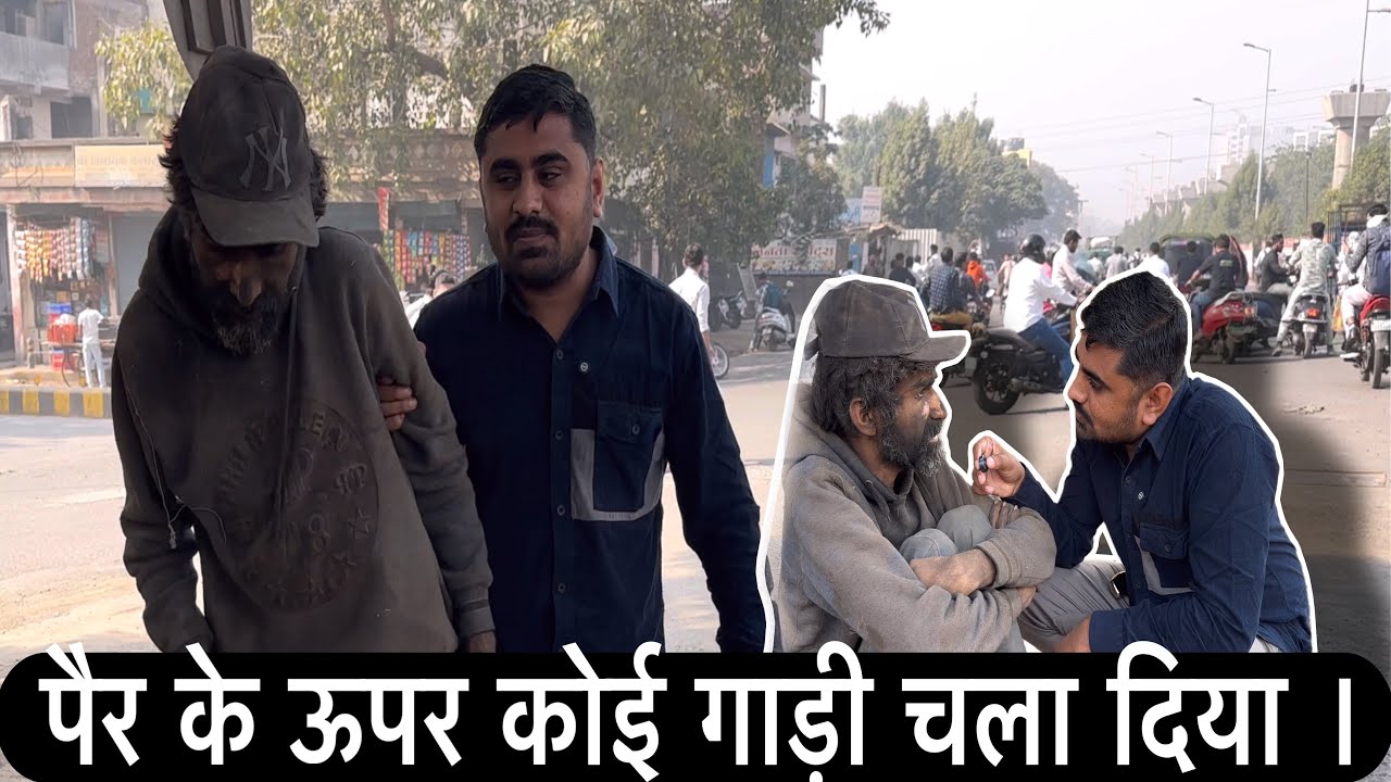 पैर के ऊपर कोई गाड़ी चला दिया | Nareshbhai Foundation | Sewa | Humanity |