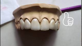 Vsmile full range CADCAM Material introduction