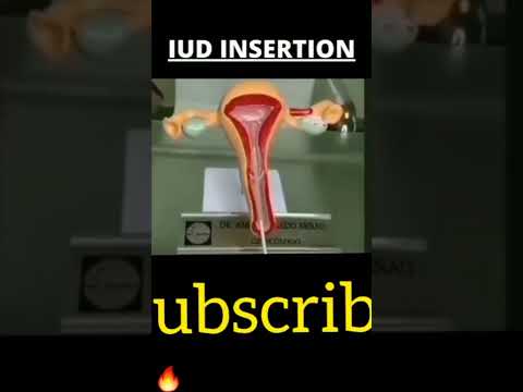 Insertion in vagina 😱#shorts #biology #maa #viral