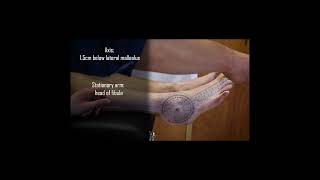 Ankle Dorsiflexion Goniometry