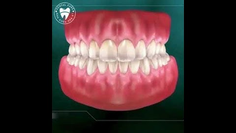 KHÁM RĂNG ĐỊNH KỲ - VIỆC NHỎ, LỢI ÍCH LỚN 🦷