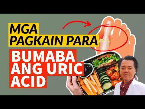 Mga Pagkain Para Bumaba ang Uric Acid - By Doc Willie Ong