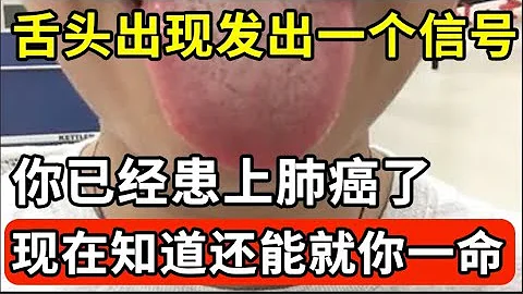 舌頭出現發出一個信號，你已經患上肺癌了！趕緊拿起鏡子看一看，別等癌症晚期才發現！【我是大醫生】 - 天天要聞