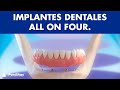 Implantes dentales - Tratamiento All on Four ©
