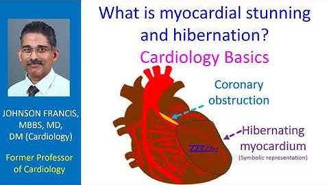 What is myocardial stunning and hibernation? Cardiology Basics
