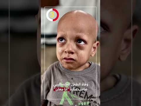 وفاة الطفل الفلسطيني صاحب عبارة أنا جعان