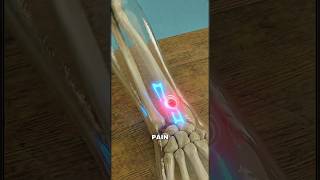 The Insect Sting That Will Literally Break You! 💀🦟 #shortsfeed