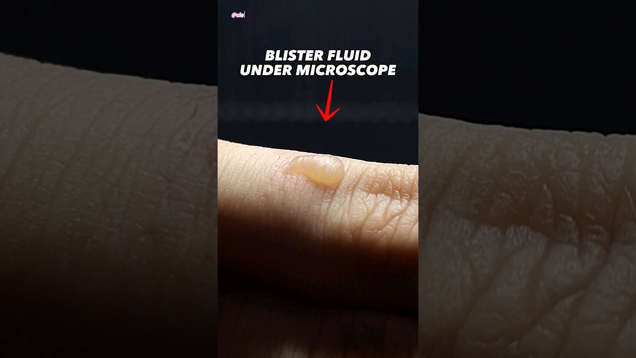 How your finger really looks under a microscope will instantly freak you  out | indy100