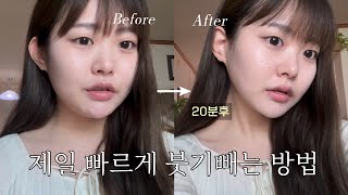 얼굴붓기 빨리 빼는법 ✧˖° 전후 차이 레전드