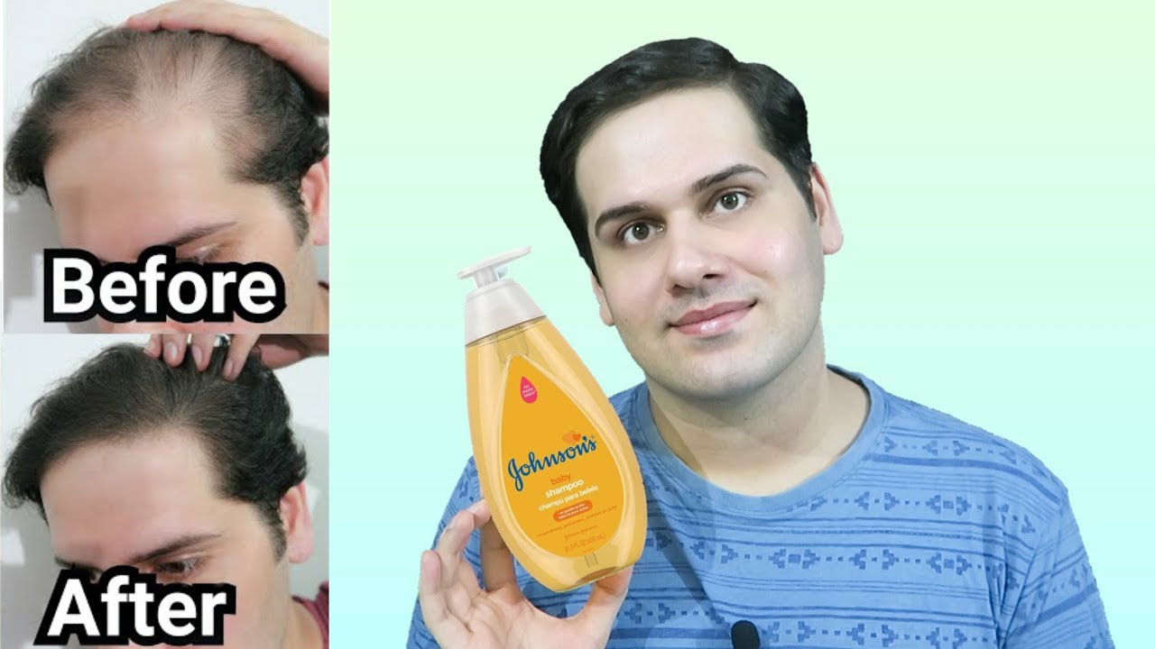 I tried Baby Shampoo for a year YouTube