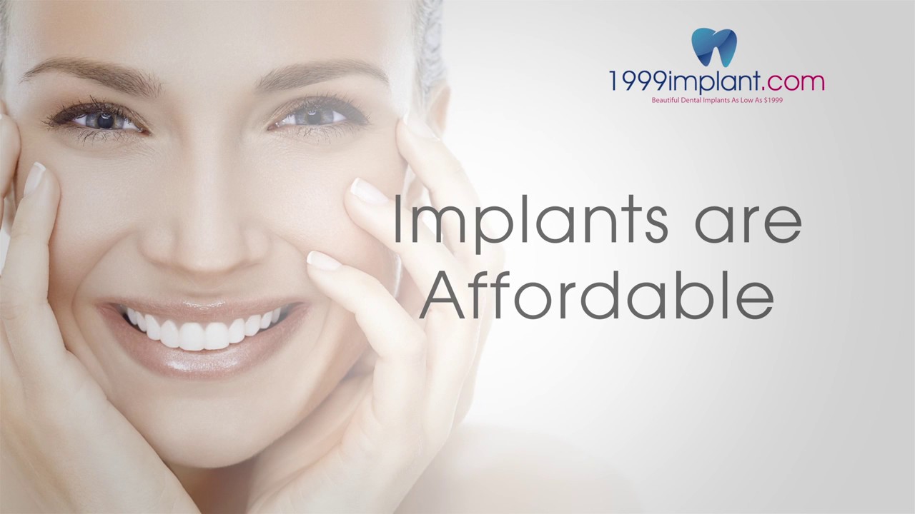 Affordable Dental Implants YouTube