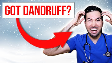 How to get rid of dandruff permanently at home and treatment
