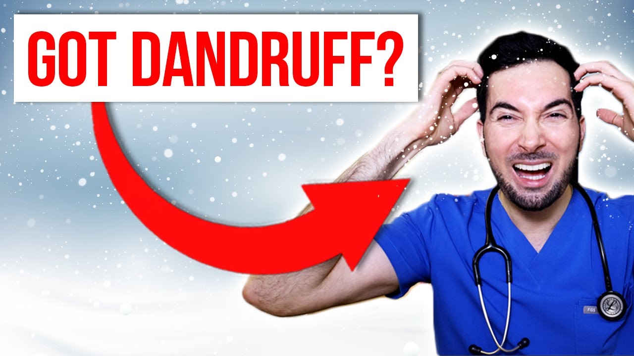 How to get rid of dandruff scratching and treatment at home