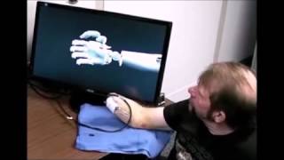 Restoring motor control and sensory feedback in people with upper extremity amputations