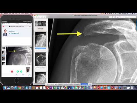Qure4u Telehealth screen-sharing