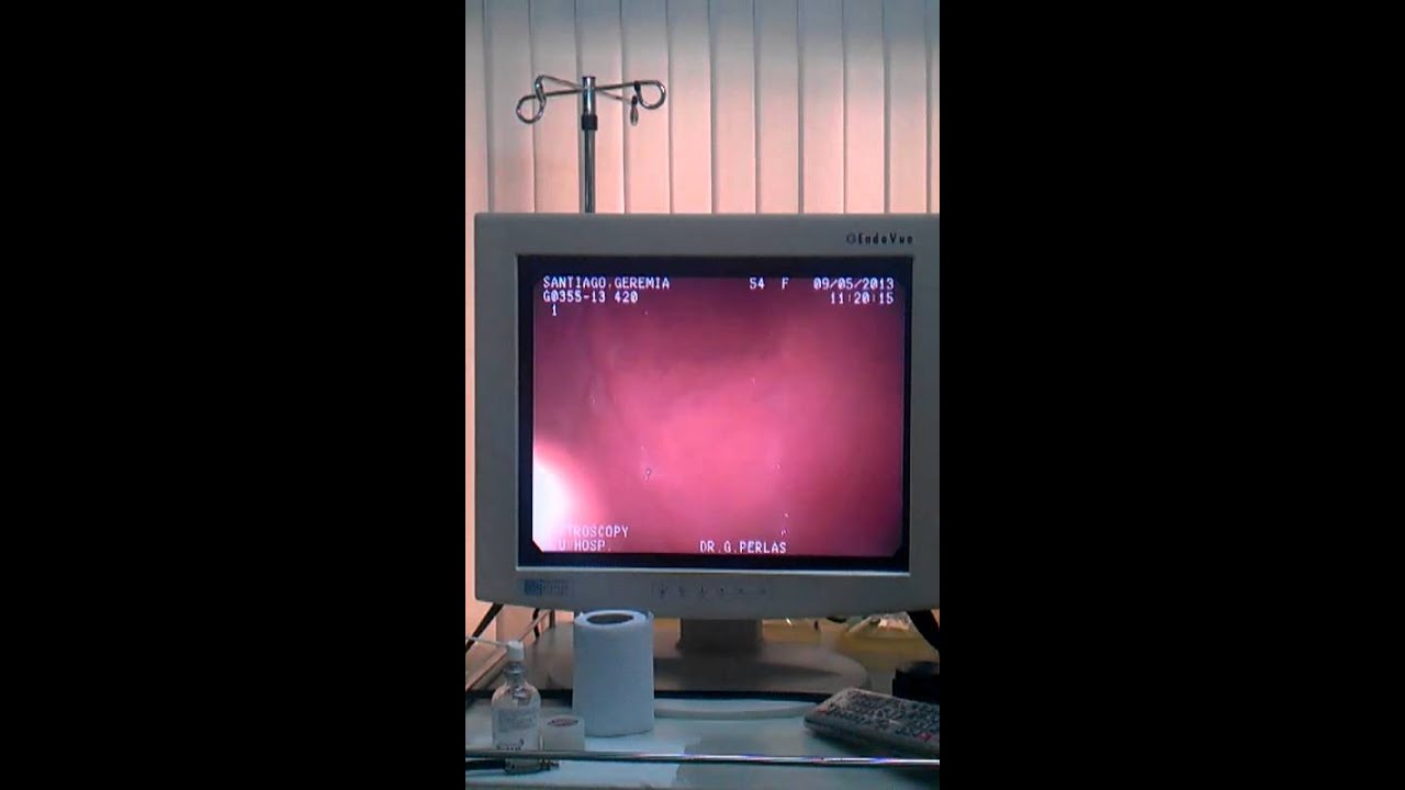 GASTROSCOPY YouTube