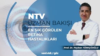En Sık Görülen Retina Hastalıkları | Prof. Dr. Peykan TÜRKÇÜOĞLU | NTV, Uzman Bakışı