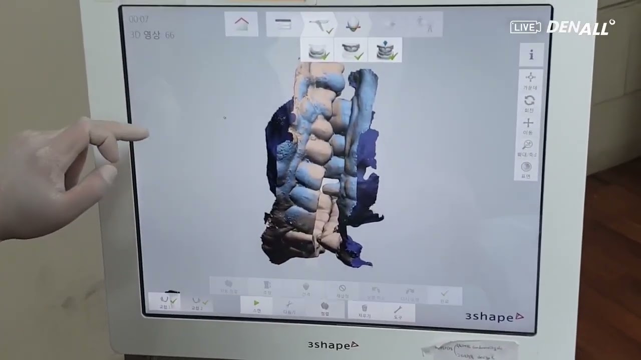 [DIGITAL DENTISTRY] Intra Oral Scan Strategy  เรียนรู้ทฤษฏีเครื่องสแกนในช่องปากและฟัน 3 มิติ