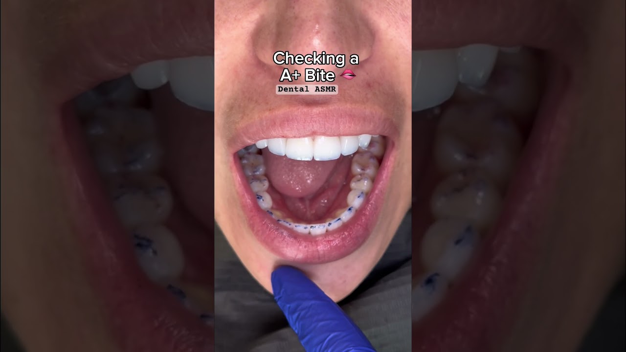 Checking the bite 🫦 