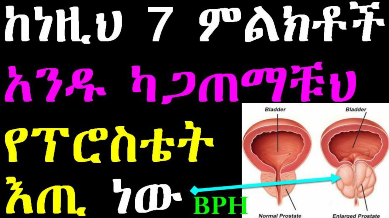 ከነዚህ 7 ምልክቶች አንዱ ካጋጠማቹህ የፕሮስቴት እጢ ነዉ❗BPH 💚💛❤ ቀኑ ሳይገፋ መፍትሄ መፈለግ ብልህነት ነዉ🔑