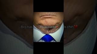 Trump got puh under his chin lol