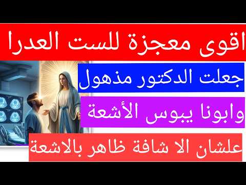 اقوى معجزة للعدرا الدكتور شهد بيها بنفسة وابونا شاف الأشعة اخدها وقبلها علشان الا شافة ظاهر فيها