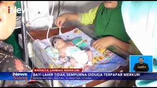 Bayi Lahir Tidak Sempurna Di Mandailing Natal, Sumut, Diduga Terpapar Merkuri - Inews Siang 2211