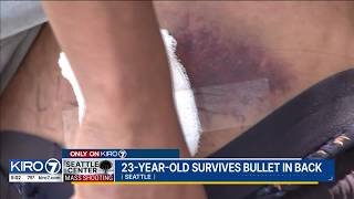 23-year-old still has bullet lodged in back from Seattle shooting