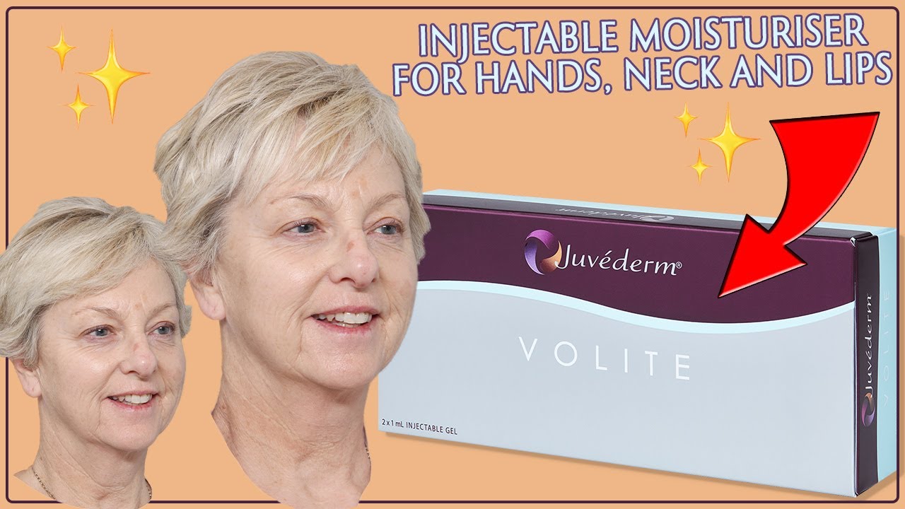 Juvederm Volite The Injectable Moisturiser Treatment for Hands, Neck