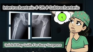 Decode Intertrochanteric VS Subtrochanteric # on X Ray : A Quick Guide for Busy Surgeons