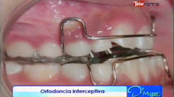Ortodoncia interceptiva