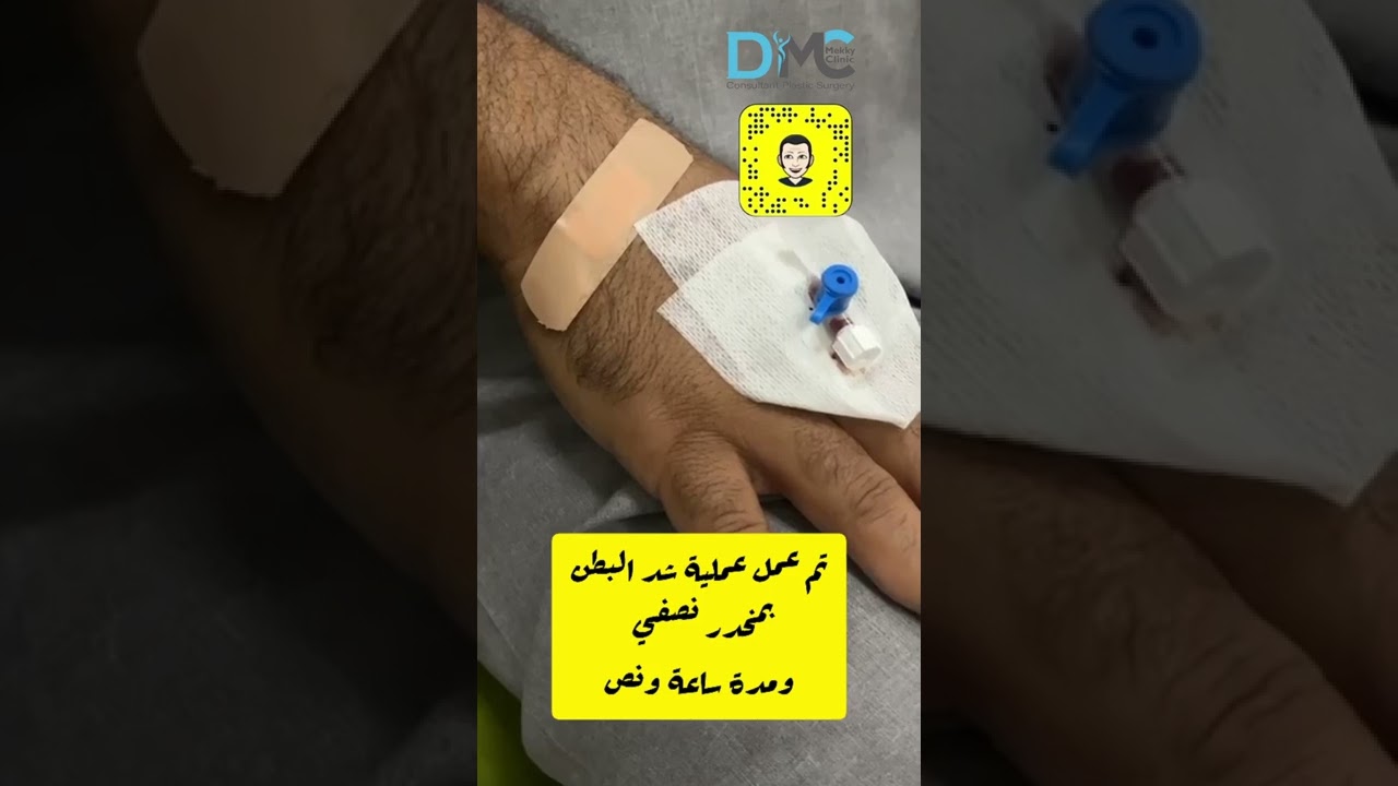 تقرير بعد عملية شد ترهلات البطن مع ابراهيم من البحرين بعيادة البروفيسور أ.د.مصطفى مكي