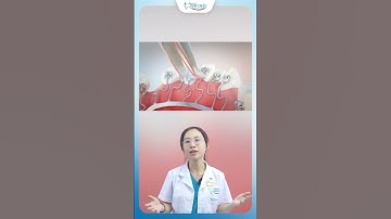 Niềng Răng Mặt Trong Có Đau Không | Nha Khoa Minh Châu