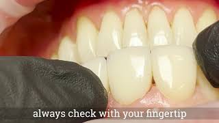 Celebrity How to check incisor contacts? Wealth