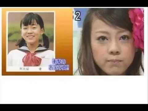 Japanese celebrities plastic surgery