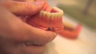 Clinical Dental Technician Lee Butler creates dentures to suit you