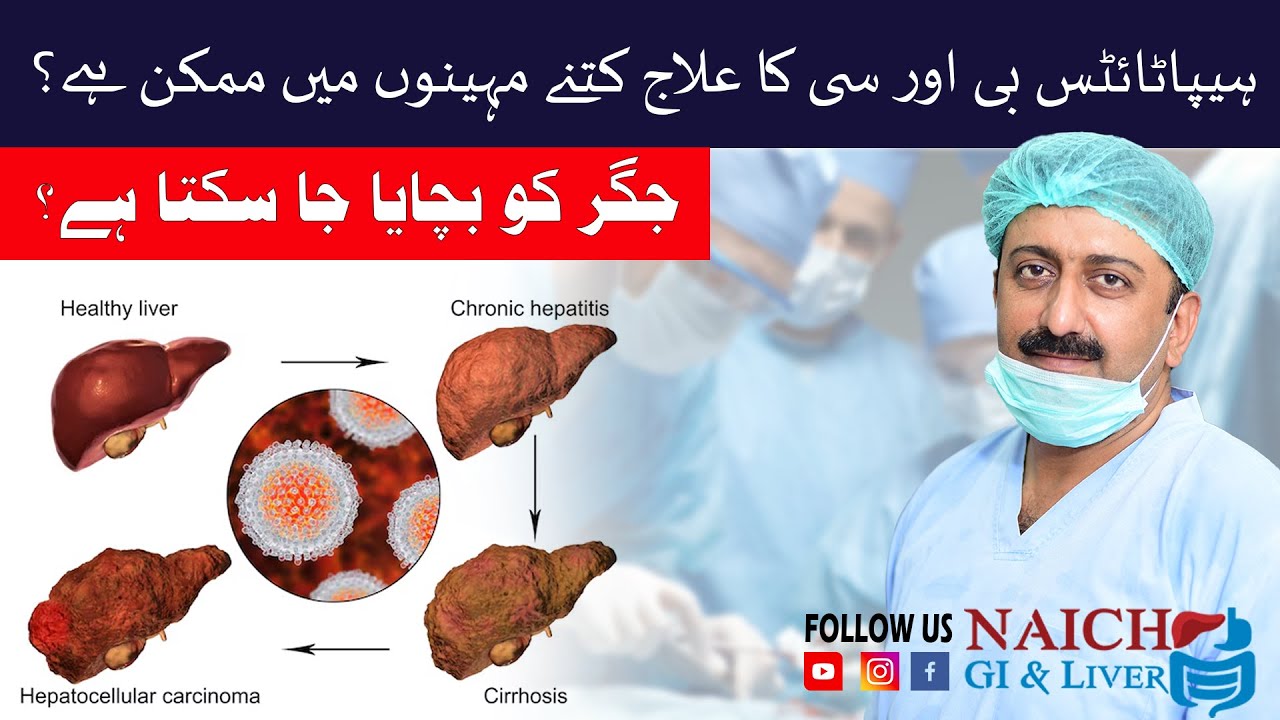 Cirrhosis of Liver due to Hepatitis B and C in Pakistan Causes Symptoms and Treatment