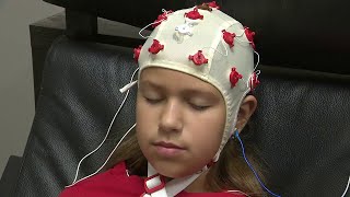 Brain treatment helps autism patients in Aventura