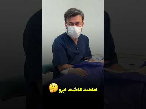 نقاهت کاشت ابرو چقدره من که شاغلم چند روز مرخصی لازم دارم