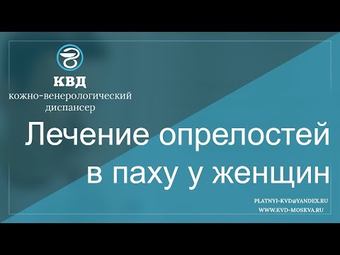 521  Лечение опрелостей в паху у женщин