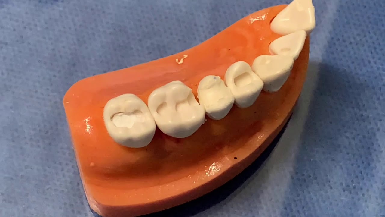 Bases y cementos dentales