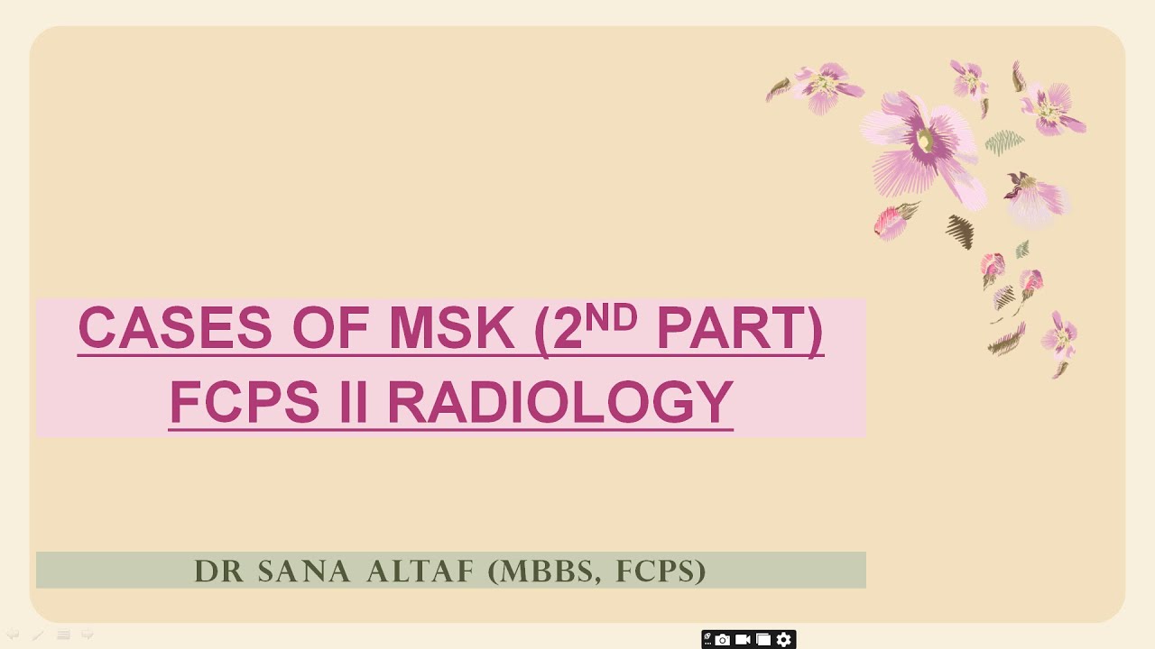 MSK (Part 2) VIVA CASES OF FCPS Part II Radiology: Real Viva Cases, Questions and Answers”