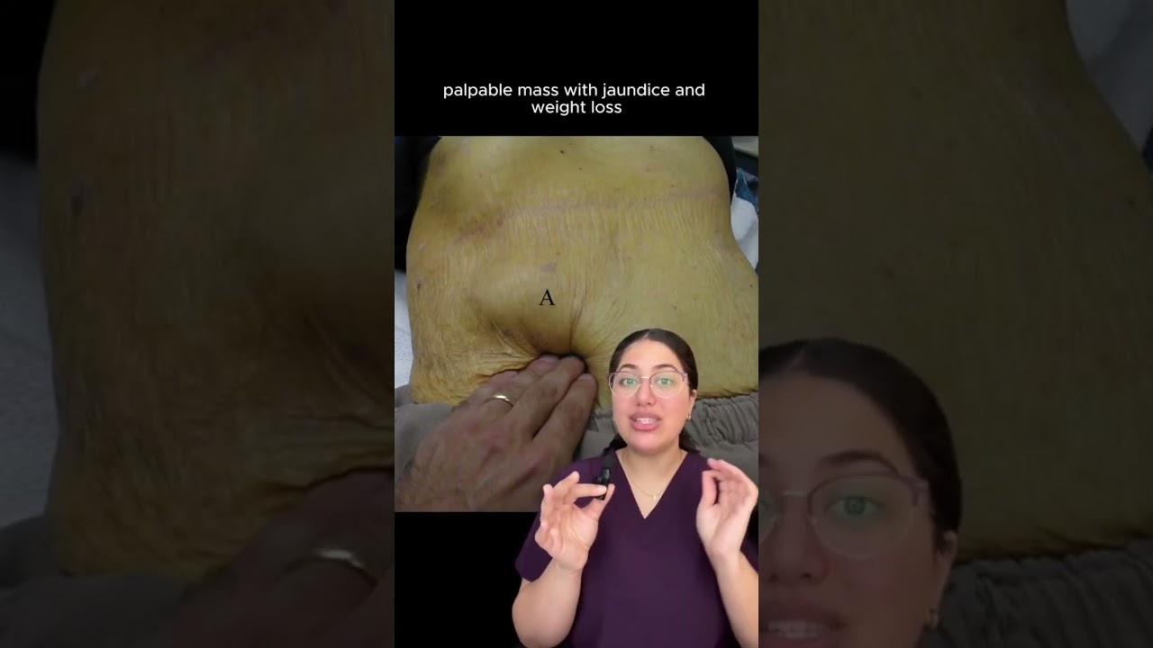 My favourite Clinical Pearls 🩺