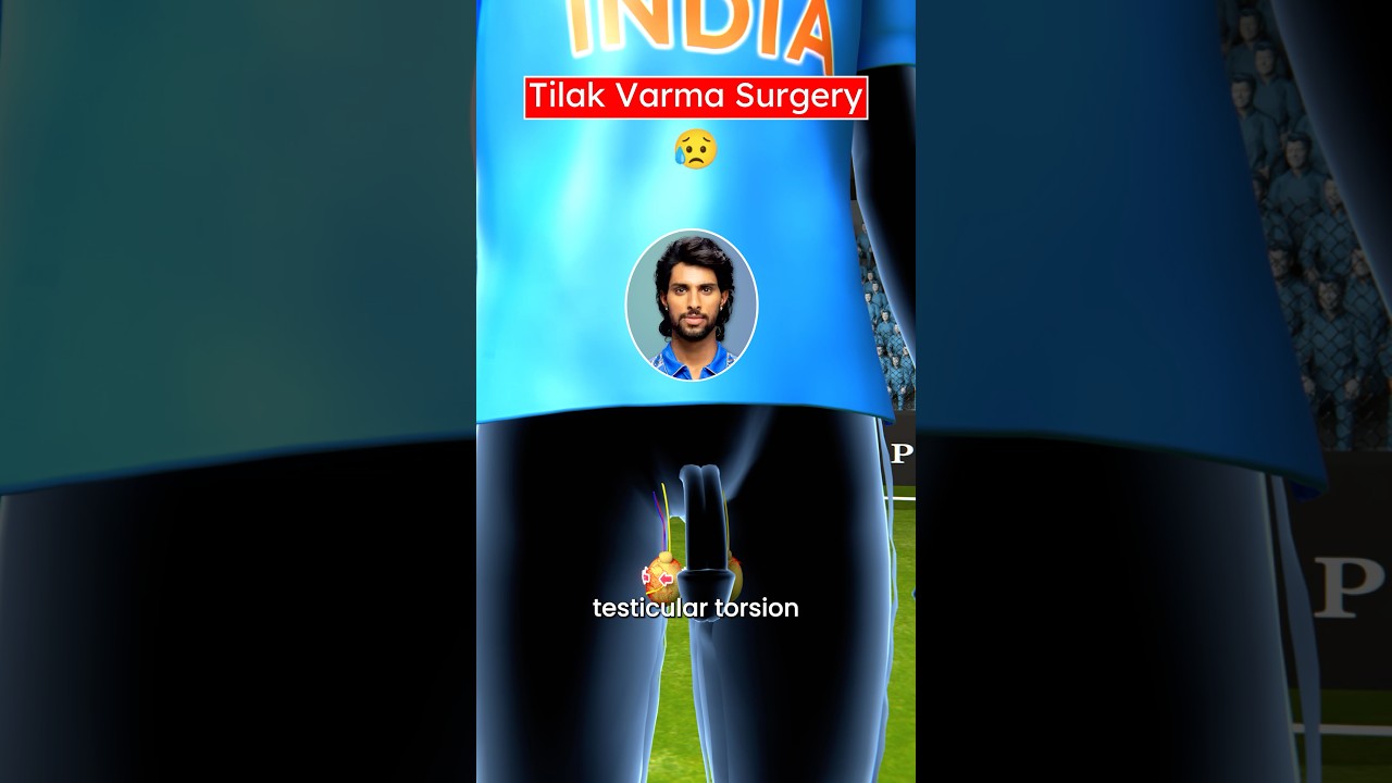 Tilak Varma’s Surgery (3D) by Professor Of How