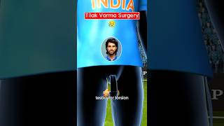 Download Lagu Tilak Varma’s Surgery (3D) by Professor Of How MP3